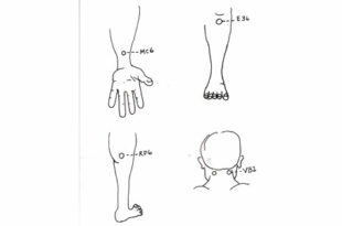 Schéma de points d'acupression en médecine chinoise : MC6 (calmer l'esprit), E36 (stimuler l'énergie vitale), RP6 (mettre en mouvement), VB20 (relier la tête et le cœur), suggérés pour mieux gérer le stress et s'adapter aux changements.