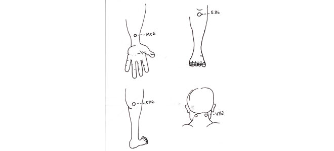 Schéma de points d'acupression en médecine chinoise : MC6 (calmer l'esprit), E36 (stimuler l'énergie vitale), RP6 (mettre en mouvement), VB20 (relier la tête et le cœur), suggérés pour mieux gérer le stress et s'adapter aux changements.